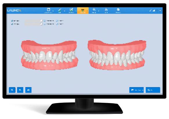 3D Intraoral Scanner - Overview 3