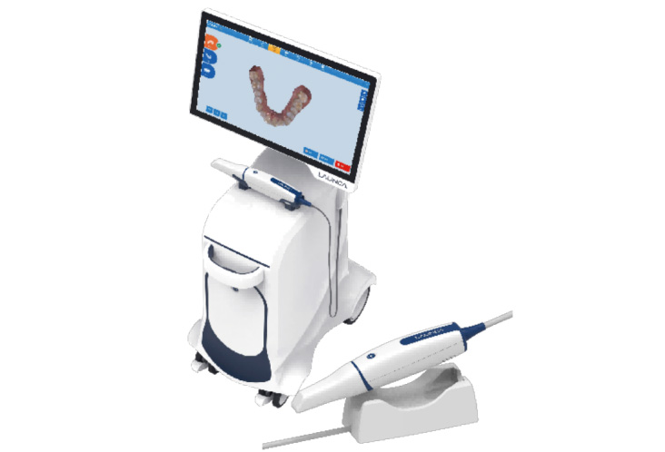 3D Intraoral Scanner - Overview 1